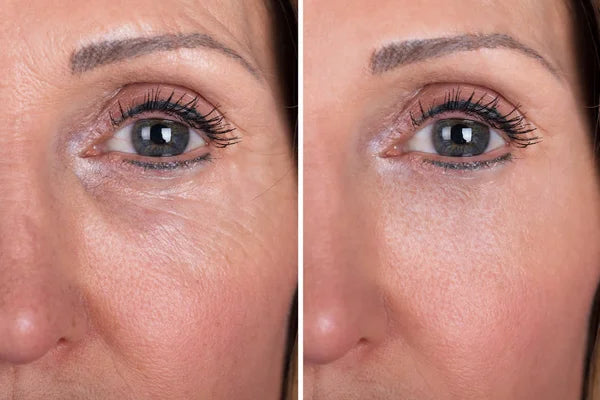 Buy Janssen - Anti wrinkle booster 2ML - at Best Price Online in Pakistan
