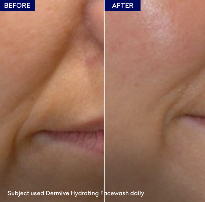 Buy Jenpharm Dermive Moisturizing Wash - 100ml - at Best Price Online in Pakistan