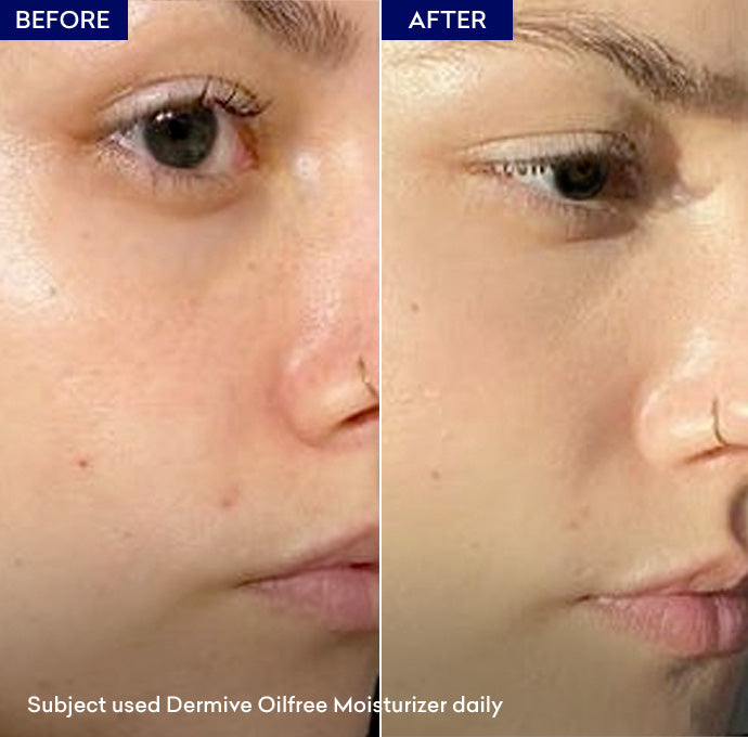 Buy Jenpharm Dermive Oil Free Moisturizer Spf 20 - 100ml - at Best Price Online in Pakistan
