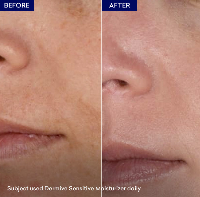 Buy Jenpharm Dermive Sensitive Moisturizer - 100ml - at Best Price Online in Pakistan
