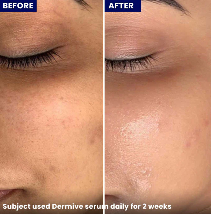 Buy Jenpharm Dermive Hydrating Serum - 20ml - at Best Price Online in Pakistan