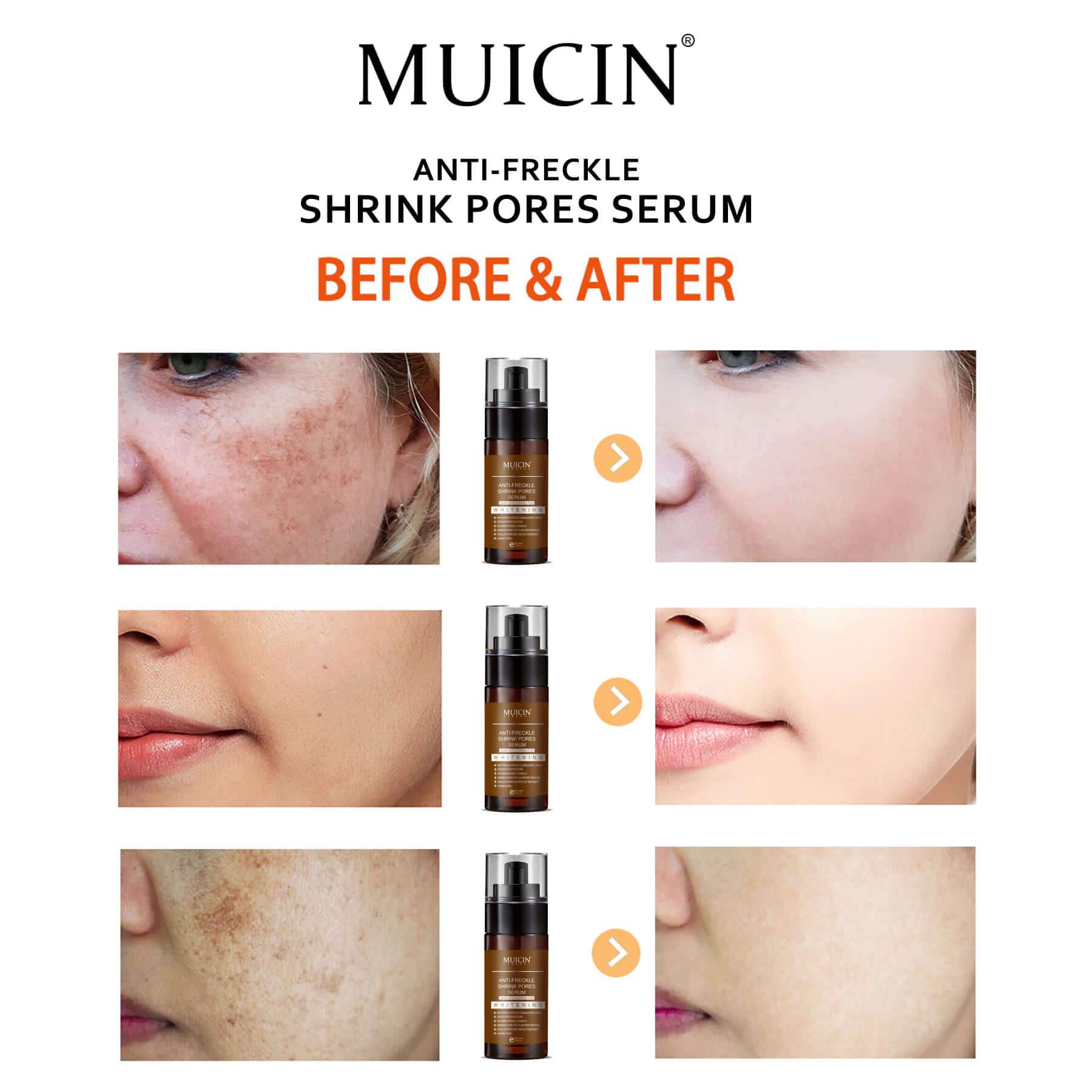 Buy MUICIN - Anti Freckle Shrink Pores Serum 40ml - at Best Price Online in Pakistan