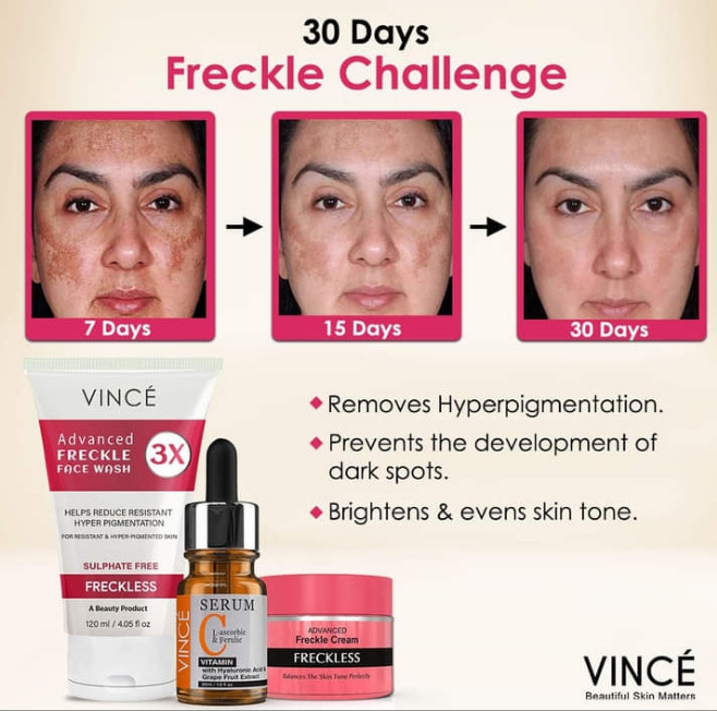 Buy Vince 30 Days Freckle Challenge Kit - at Best Price Online in Pakistan