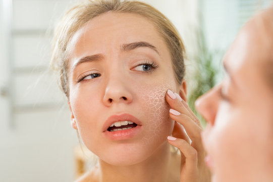 The Ultimate Guide to Treating Dry Skin