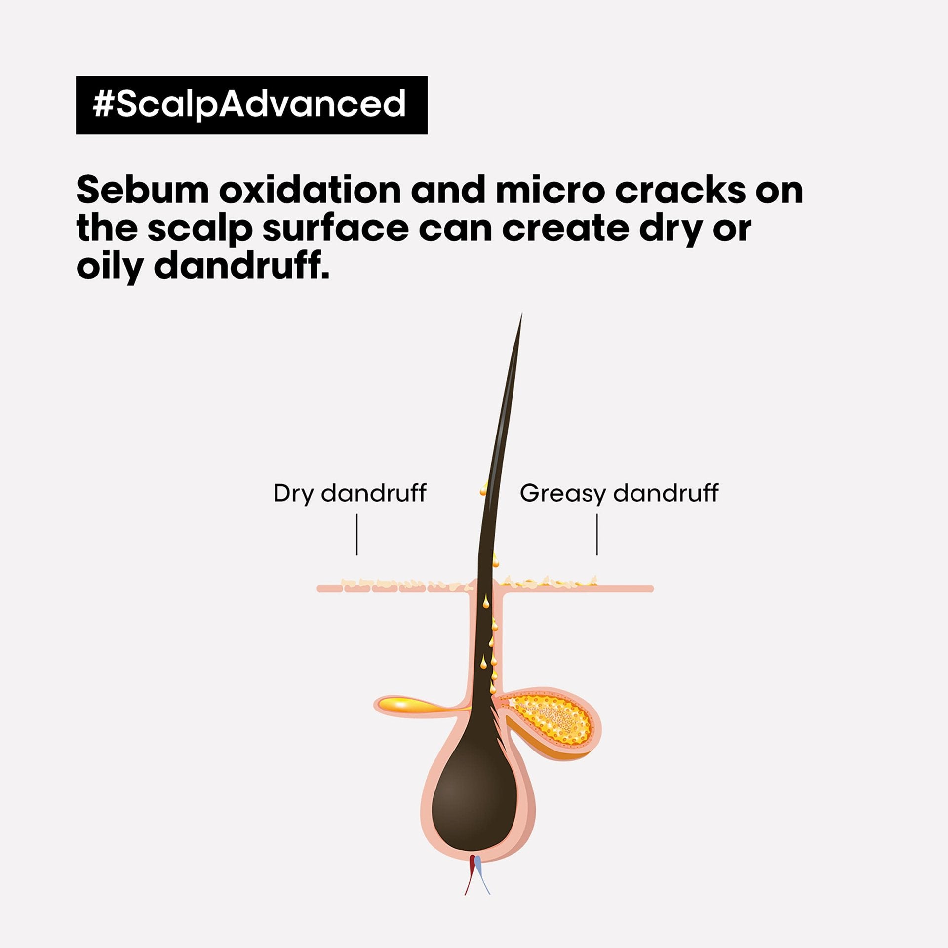 Buy  L'Oreal Professionnel [Scalp Advanced] Anti-Oiliness 2-In-1 Deep Purifier Clay - at Best Price Online in Pakistan