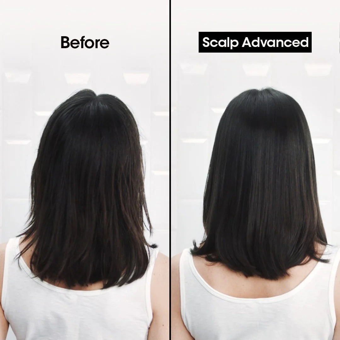 Buy  L'Oreal Professionnel [Scalp Advanced] Anti-dandruff dermo-clarifier shampoo 1500ml - at Best Price Online in Pakistan
