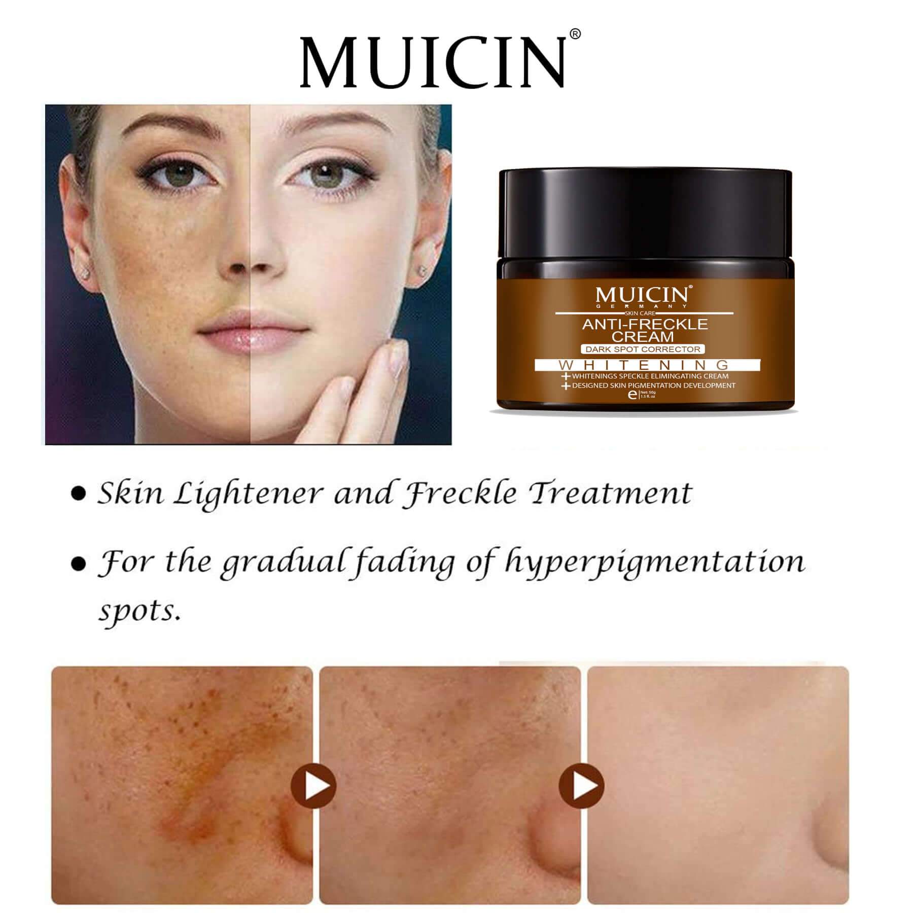 Buy  MUICIN - Anti Freckle Cream - 50g - at Best Price Online in Pakistan