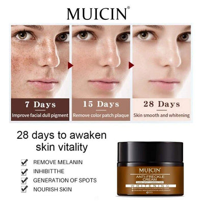 Buy  MUICIN - Anti-Freckle Deal - at Best Price Online in Pakistan