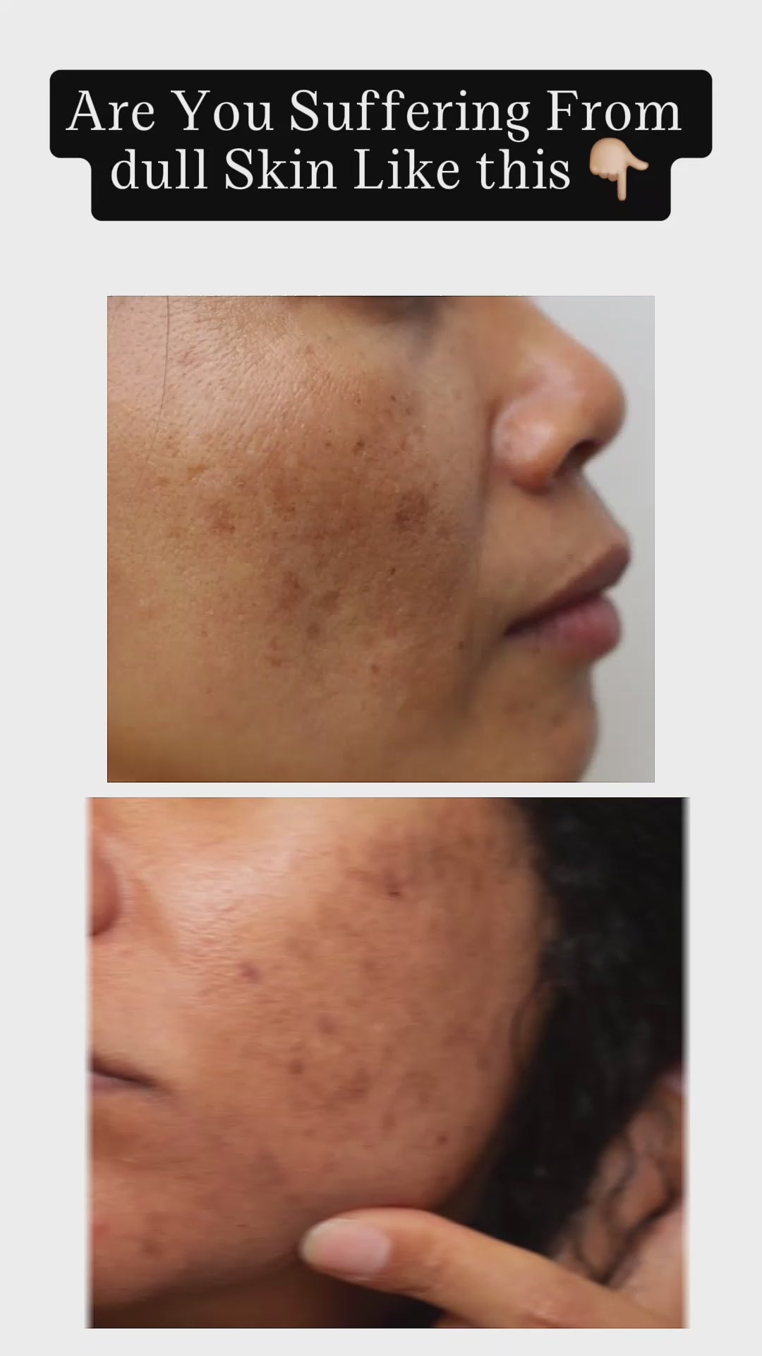 Buy  Vince Vitamin C Face Serum - 30ml - at Best Price Online in Pakistan